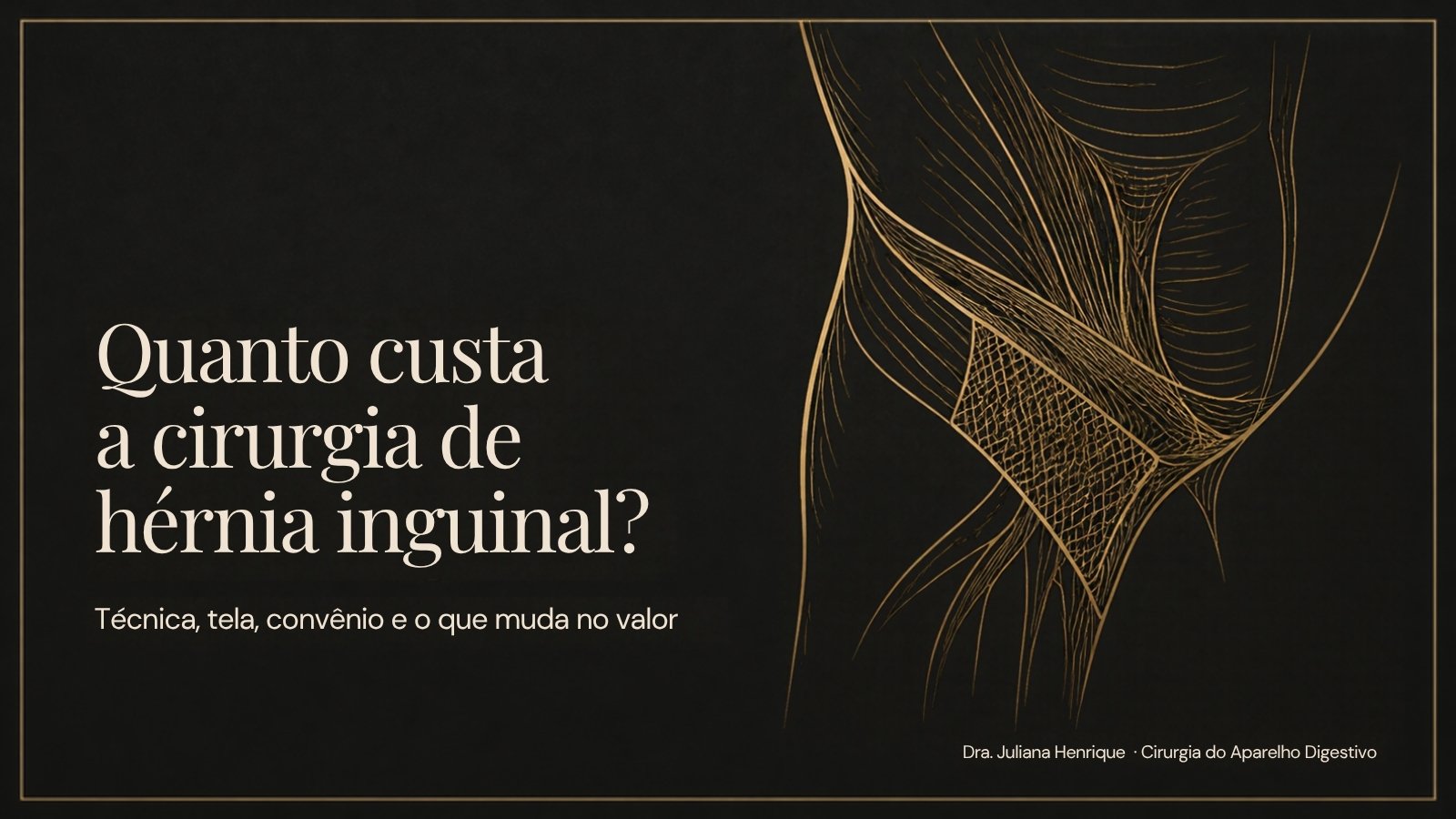 Ilustração da parede abdominal com tela de reforço: quanto custa a cirurgia de hérnia inguinal
